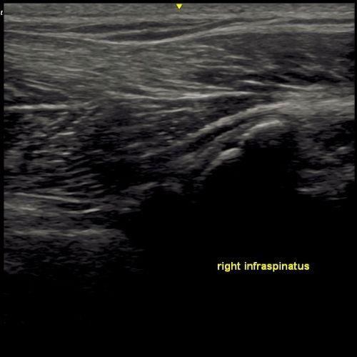 VSMR MSK Ultrasound